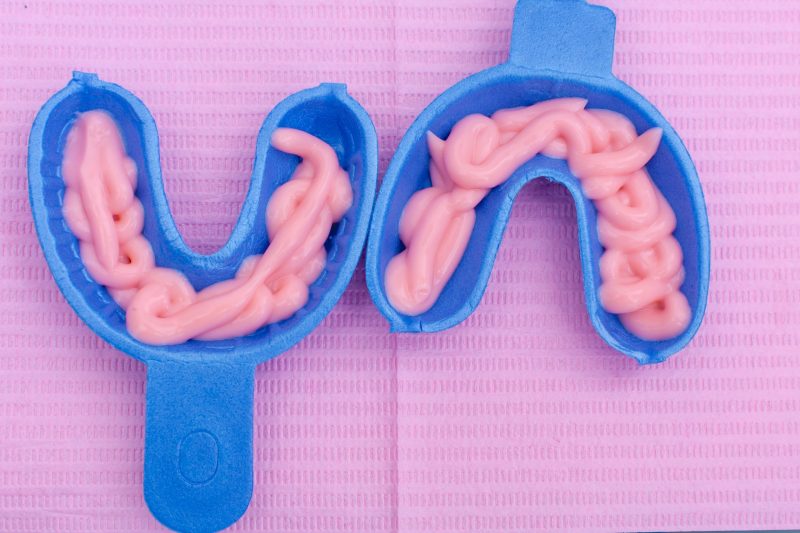 fluoride treatment vineyard